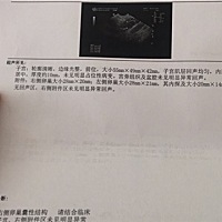 有没有人知道这是排卵了还是没排