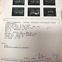各位姐姐帮我看一下是男宝女宝？40几天孕囊是45*24*16。谢谢了