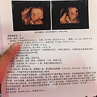 男宝还是女宝？