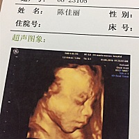 四维通过啦…小家伙特别不配合，光盘还复刻下来担脸偷笑的画面，不知道男孩还是女孩呢？有人看得懂的吗