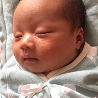 亲们帮看一下，一个月的宝宝脸上长的是湿疹吗？头上也有，该怎么护理？🙏