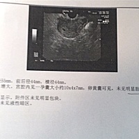 4.21末次月经，到现在还没有胎心，医生说着床晚，过两个星期再照一次，5.26晚有点褐色分泌物，应该就是...