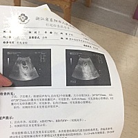 亲 双胞胎 看的出来是男孩还是女孩吗？纯属娱乐 不喜勿喷