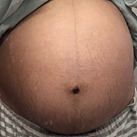 宝宝总算顺利出生，龙凤胎，38周刨妇产，哥哥5斤2两妹妹7斤