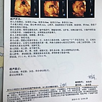为什么看别的宝妈发的四维单子的四肢写的那么清楚，我的就几个字啊？😂 第一胎，有看得出来是男宝女宝...