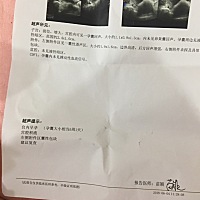 大家帮我看看 我未次月经是4月9号 怎么去B超 才五周啊。而且还没有胎心。去B超还说我积液多 会不会有事...