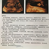 会看的宝妈，帮我看看是男宝女宝