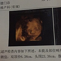 昨天做的三维，两个宝贝长的好像，嘴巴和下巴一摸一样。觉得好有意思😄