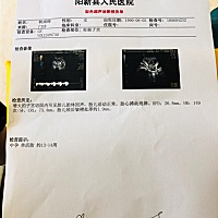 我老婆刚做完NT，怀胎十月的女人最伟大了，我爱你！大伙看看，是男宝还是女宝？