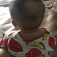宝宝这头发怎么回事，三个月了