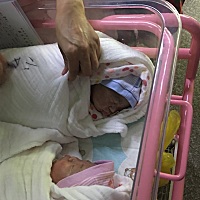 30周发现胆淤，坚持到34周6天，发展成重度，医生就建议不要再保了很危险，于是当天下午就剖了！于2018年...