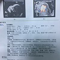🌺🌺💋💋会看性别的宝妈们快来围观，系统b超看看是男宝还是女宝。🌺🌺