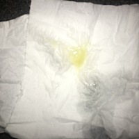 凌晨有用房，没采取措施，然后早上上厕所排出像果冻的东西，这是什么情况！急，在备孕阶段