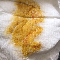 快三个月纯母乳宝宝，今天检查尿不湿发现有红色丝状，不知道是什么？跪求告知