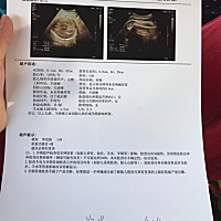 宝妈帮我看看双肾肾虚分离0.6没事吧不是肾积水吧
