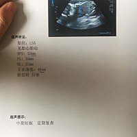 早上六点我还没醒，宝宝就在肚子里翻江倒海。八点起床后就没动静了，吓得汗都出来了。幸好看了医生说宝...