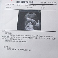 11周单子可以看出男宝女宝吗？