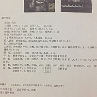 宝马们 帮忙看哈是男孩还是女孩