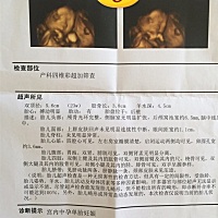 男宝还是女宝，好奇呀
