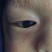 宝宝从出生到现在一个月了 眼球边上有一层膜 跟戴了隐形眼镜一样 怎么回事