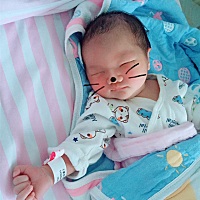 6月6号下午剖腹七斤男宝一枚