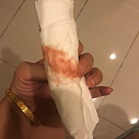 昨天测弱阳今天怎么就这样了，这是什么情况呀……