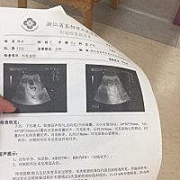 孕妈们 我5月28日第一次做的检查 我想问一下第二次检查我应该什么时候去做 应该检查什么