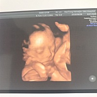 有人能看出男宝，女宝吗？😍