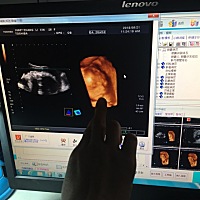 我家小可爱呀……^_^^_^^_^^_^标准的小美女一枚