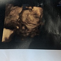 今天我说宝宝好难看，老公一下就生气了。😠