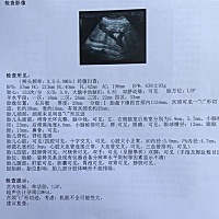 请问可以看出是男宝还是女宝吗