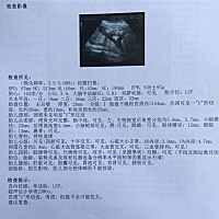 有大神能看出是男宝还是女宝吗 万分感谢