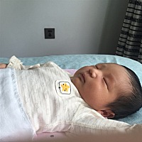 孩子第八天时候发现脸有点黄，今天第十天，有没有关系？需不需要去儿科看一下？