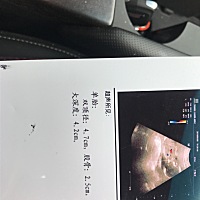 帮帮忙看看男孩女孩