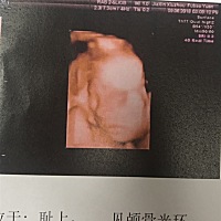 各位孕妈们，看得出来是男宝女宝嘛。👶🏻