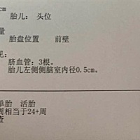 胎儿左侧侧脑室内仅0.5Cm。你们有类似的情况吗。后期怎么样。很担心 半个月以后去复查