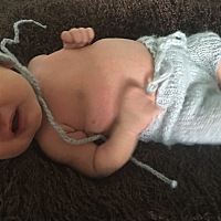 宝贝21天肚子特别大。宝妈们帮我看看正常吗