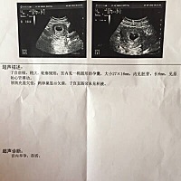 努力的我！终于有了结果！