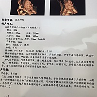 大家看下是女宝还是男宝？