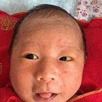 求解 宝宝脸上起的这些小白疙瘩是什么啊！是不是湿疹？怎么办