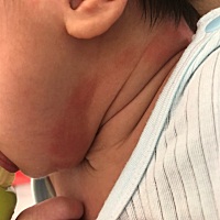 大家帮忙看一下20天宝宝起的是什么急急急