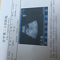 怎么看二胎男女