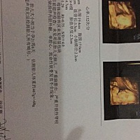 为啥我这四维文字描述这么简单的，有没有必要换个医院再做一次呀？