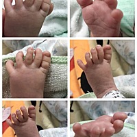 👶🏻宝宝出生第五天，打卡