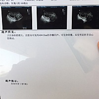 孕8周了。第二次彩超，孕囊长大了一倍，但还是没看见胎心胎芽哦。各位宝妈 怎么办 好害怕