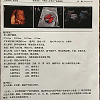 有懂的孕妈可以帮忙看看吗？？？简直看不懂，也看不出来是男孩还是女孩！