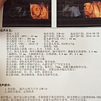 大家帮忙看看 是男孩还是女孩 第一胎无所谓 纯属好奇 娱乐一下