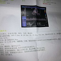 好奇怀的是男宝宝还是女宝宝，亲们帮忙看看。