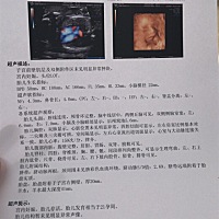 热乎的四维！好奇的心！男宝or女宝？