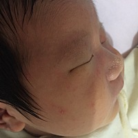 宝宝脸上起痘痘怎么回事